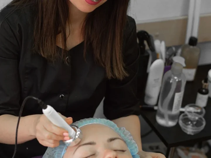 PDO thread lift facial treatment