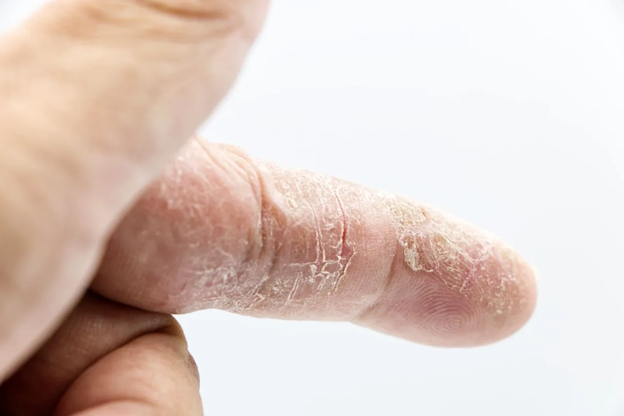 Skin tightening treatment close-up