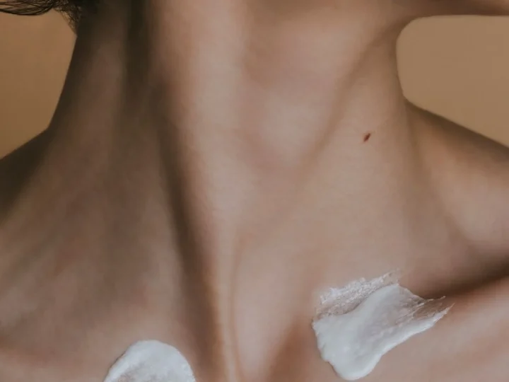 Kybella treatment for submental fullness
