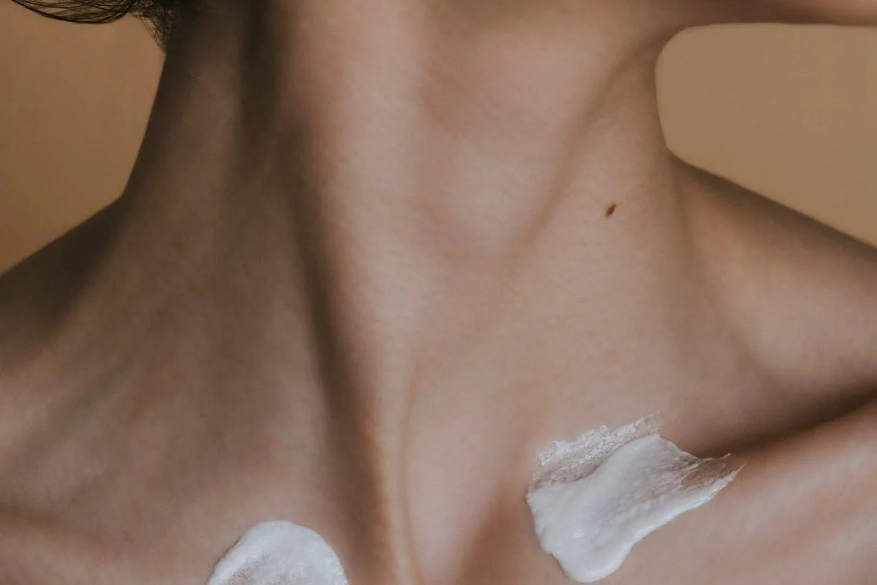 Kybella treatment for submental fullness